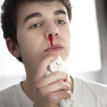 Кровь из носа у взрослых мужчин: причины и способы предотвращения